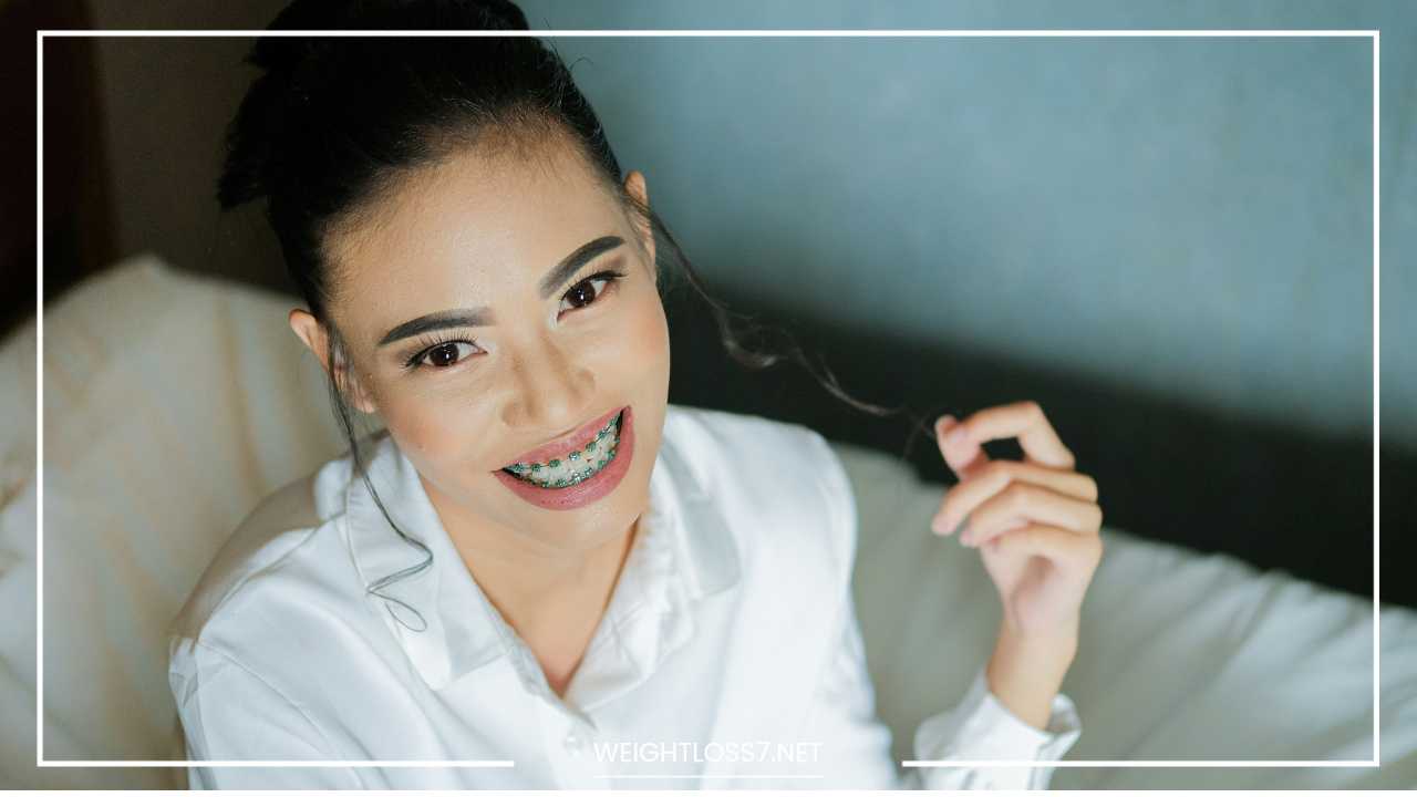 Dental Braces